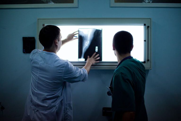 Diagnose von Arthrose auf X -Strahlen