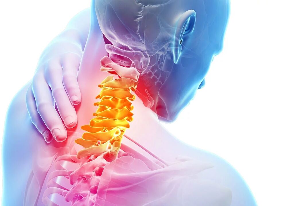 Zervikale Osteochondrose